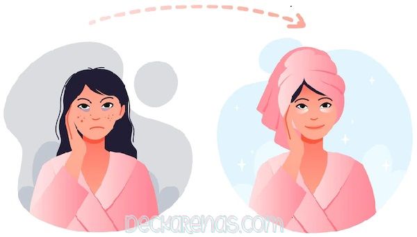 Ciri-ciri Kulit Cocok Menggunakan Cream HN asli