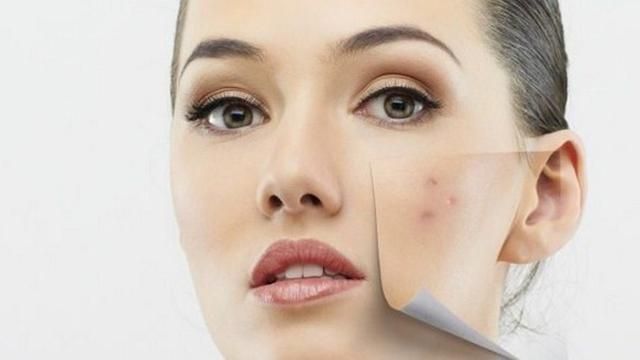 Manfaat Salicylic Acid Untuk Perawatan Kulit Wajah